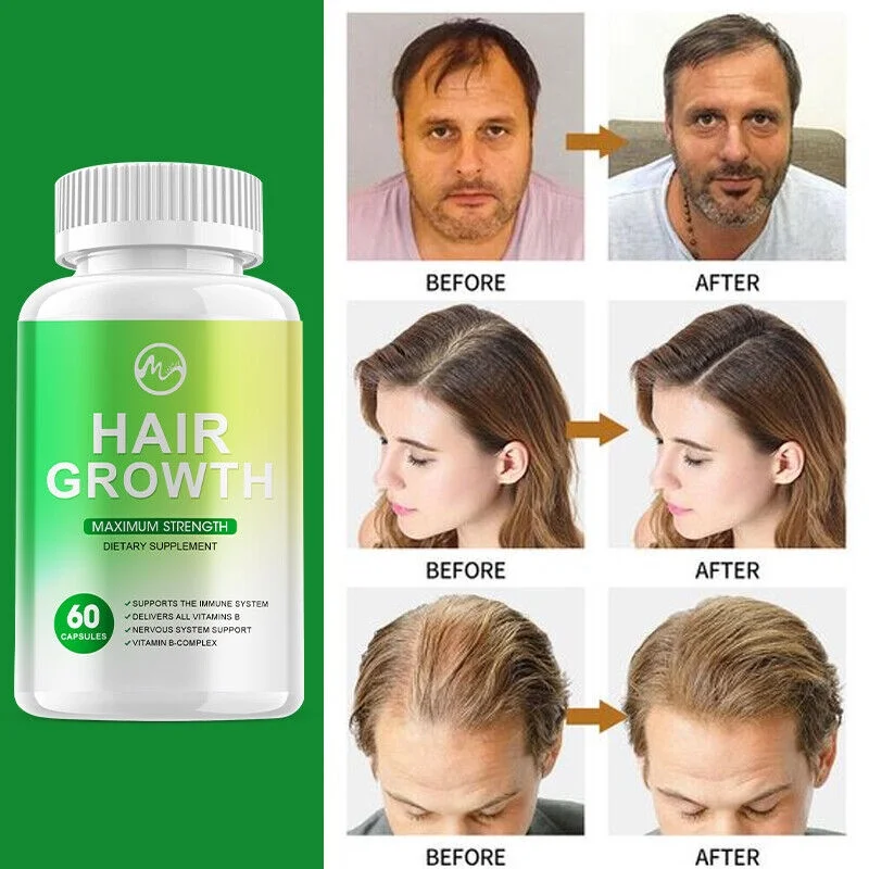 Minch Hair Growth Vitamins For Men Women Anti Hair Loss 60 Capsules