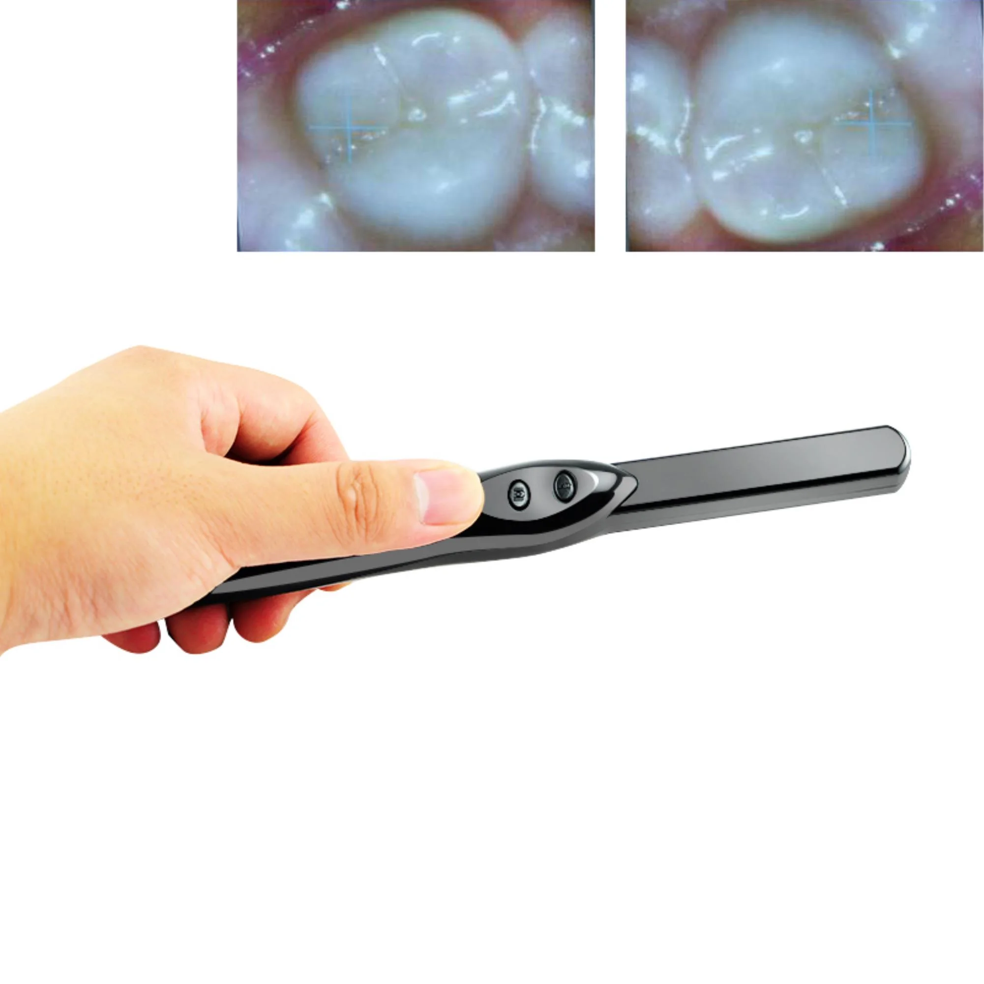 Experience Clear Oral  Imaging with the Dental Intraoral Camera – High-Resolution 6MP, 6-LEDs, USB 2.0