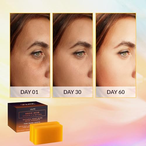 VALITIC 4 Pack Kojic Acid Vitamin C & Retinol Soap Bars for Dark Spot & A Pair Of Turquoise Exfoliating Gloves for Body Scrubs