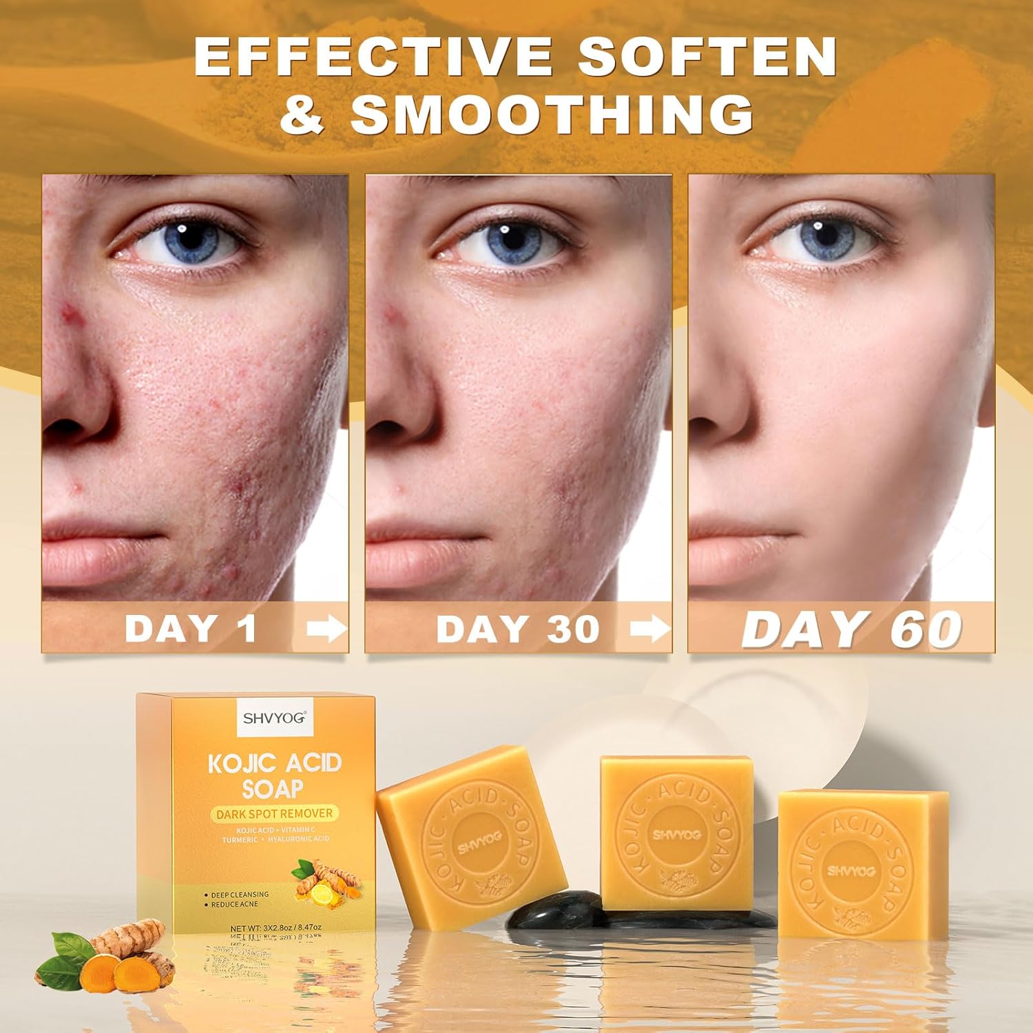 SHVYOG Kojic Acid Soap, Turmeric Soap Bar, Dark Spot Remover with Vitamin C Hyaluronic Acid for Deep Cleansing, Gentle Soap for Face and Body with A Foaming Net, 8.47oz（3 Pack）