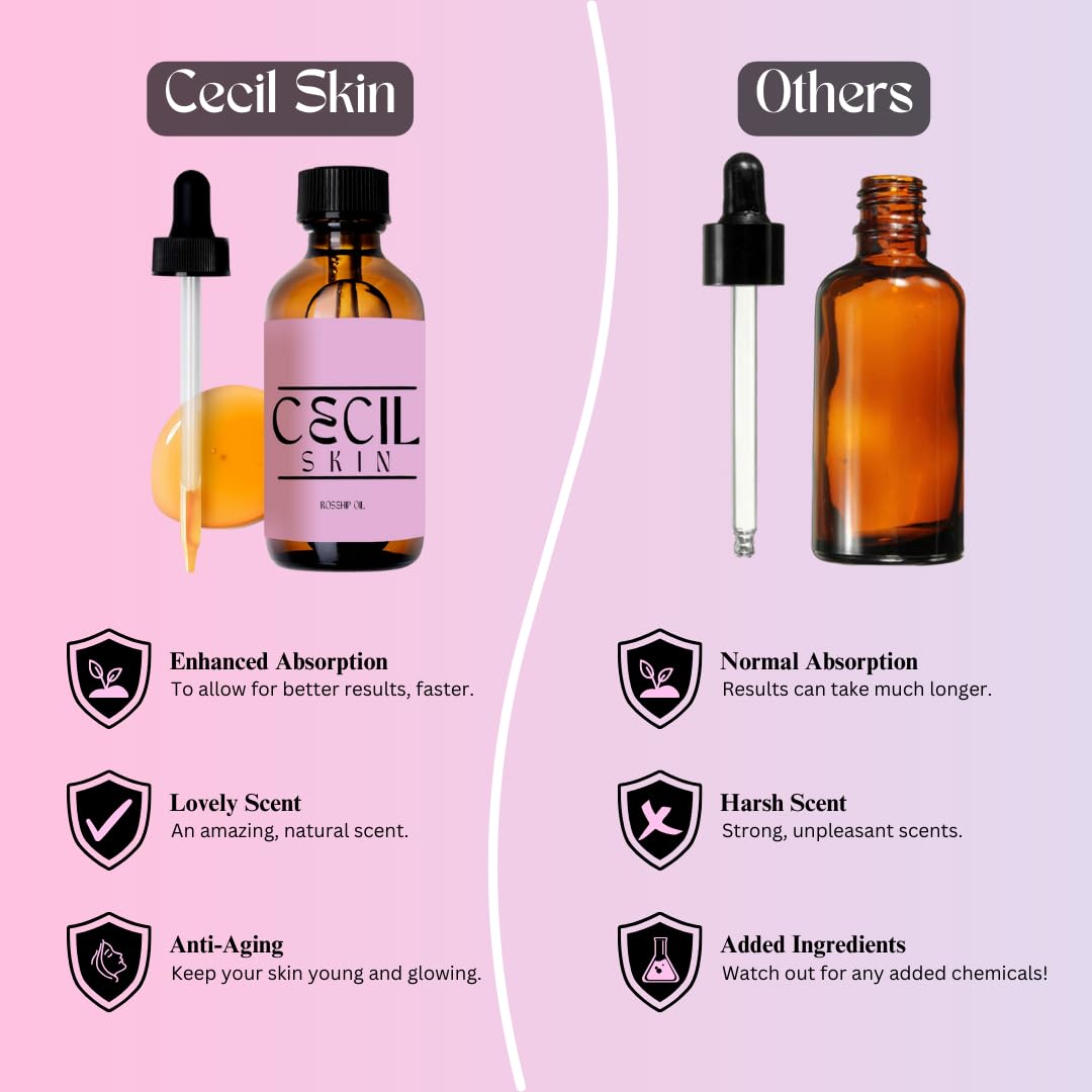 100% Organic Rosehip Oil for Anti-Aging, 2 oz (60ml), Cold-Pressed, Reduces Wrinkles, Hydrates & Moisturizes Face with Vitamin A - Ideal for Face, Hair, and Nails | 90-Day Satisfaction Guarantee