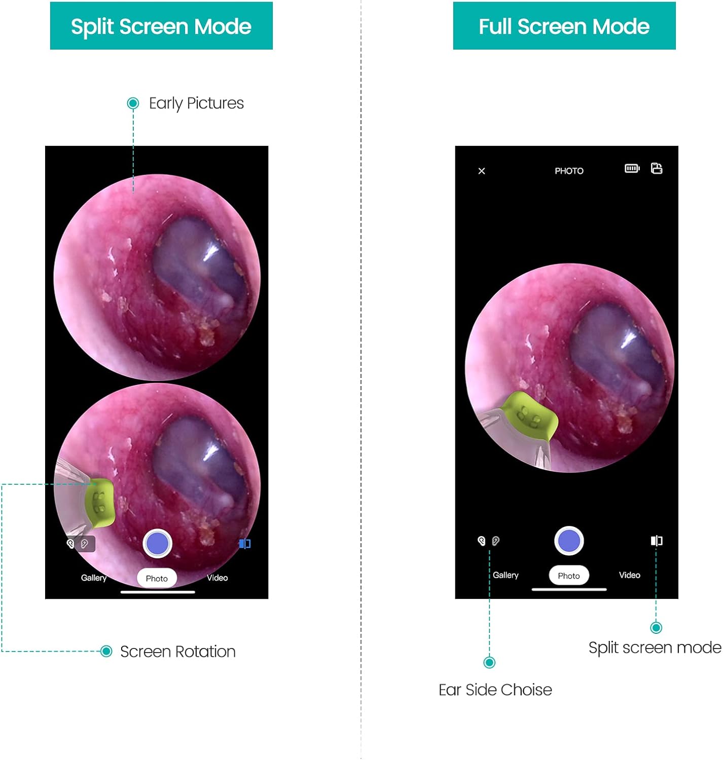 Wireless Otoscope Ear Camera with Dual View, 3.9mm 720PHD WiFi Ear Scope with 6 LED Lights for Kids and Adults, Compatible with Android and iPhone