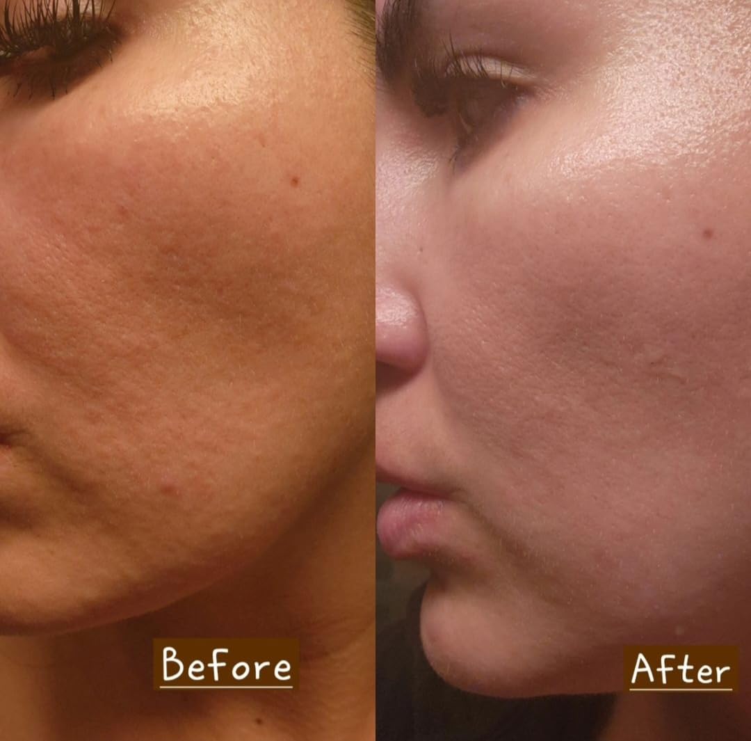 Rejuvenating Facial Night Cream with Retinol, Tepezcohuite, & Niacinamide