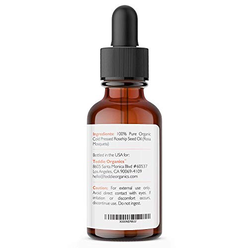 Organic Rosehip Oil – 100% Pure Unrefined Cold Pressed Rosehip Seed Oil - Best Moisturizer for Face, Hair - Great for Fine Lines, Wrinkles, Acne Scars, Sun Damage, Stretch Marks, Eczema, Psoriasis