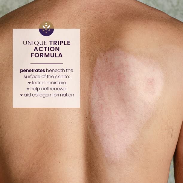 Mederma Gel 20 g, 0.7 Oz(Pack of 2)