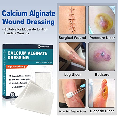 Ag Silver Calcium Alginate Wound Dressing Pads, 4''x4'' Patches, 10 Individual Pack, Soft Silver Dressings for Wound Care, Gentle Highly Absorbent Dressing, Non Stick Gauze Pads for Wounds