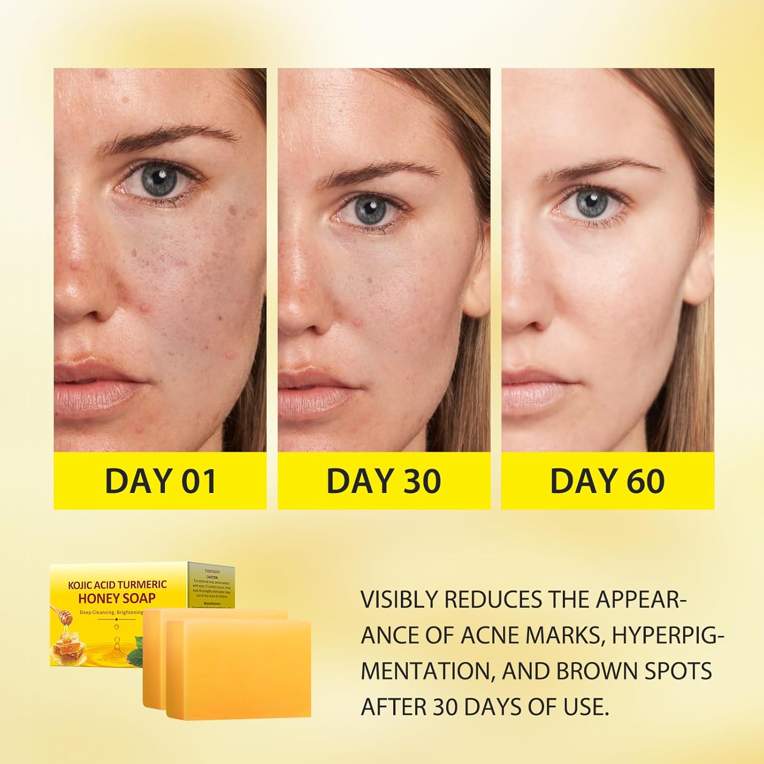 Tamoskiny Honey Glow Lemon Turmeric Kojic Acid Soap Bar for Hyperpigmentation, Lemon Turmeric Kojic Soap for Dark Spots Remover, Deep Cleansing Face Organic Turmeric Soap Bar 7OZ (2 Bars)