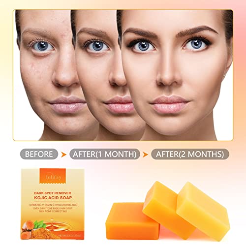 Inlifay Kojic Acid Soap Dark Spot Remover : Turmeric Soap with Vitamin C, Vitamin E, Retinol, Collagen, Hyaluronic Acid, Moisturizing for Body & Face