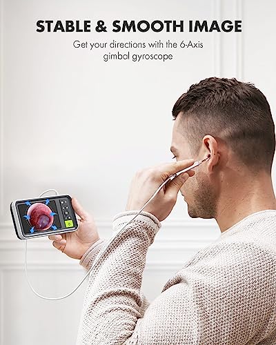 Anykit Digital Otoscope with Gyroscope, 4.5 Inches Screen, 3.9mm Ear Scope Camera with 6 Lights, Ear Wax Removal Tool, 32GB Card, Supports Photo Snap and Video Recording