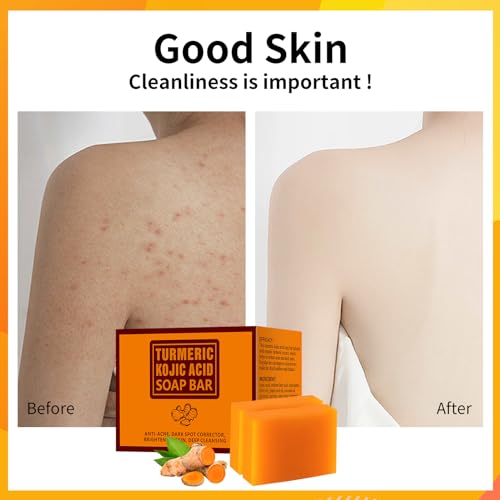 Koji Acid Soap for Dark Spots, Turmeric Soap for Face and Body, Kojic Acid Soap Skin Brightening Tumeric Soap for Acne Dark Spots Hand Soap Bar Acne Face Bar Deep Cleansing Face Wash 200g/7OZ