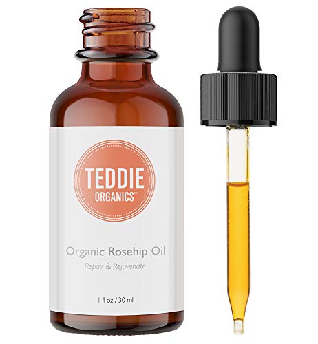 Organic Rosehip Oil – 100% Pure Unrefined Cold Pressed Rosehip Seed Oil - Best Moisturizer for Face, Hair - Great for Fine Lines, Wrinkles, Acne Scars, Sun Damage, Stretch Marks, Eczema, Psoriasis