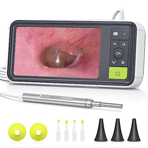 Anykit Digital Otoscope with Gyroscope, 4.5 Inches Screen, 3.9mm Ear Scope Camera with 6 Lights, Ear Wax Removal Tool, 32GB Card, Supports Photo Snap and Video Recording