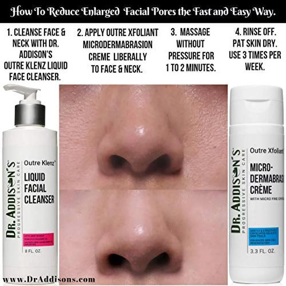 Dr. Addison's Outre Xfoliant Microdermabrasion Creme 3.3 oz Micro Fine Crystals | Dry, Dull, Oily Skin Cleanser | For Wrinkles, Acne Scars & Blemishes