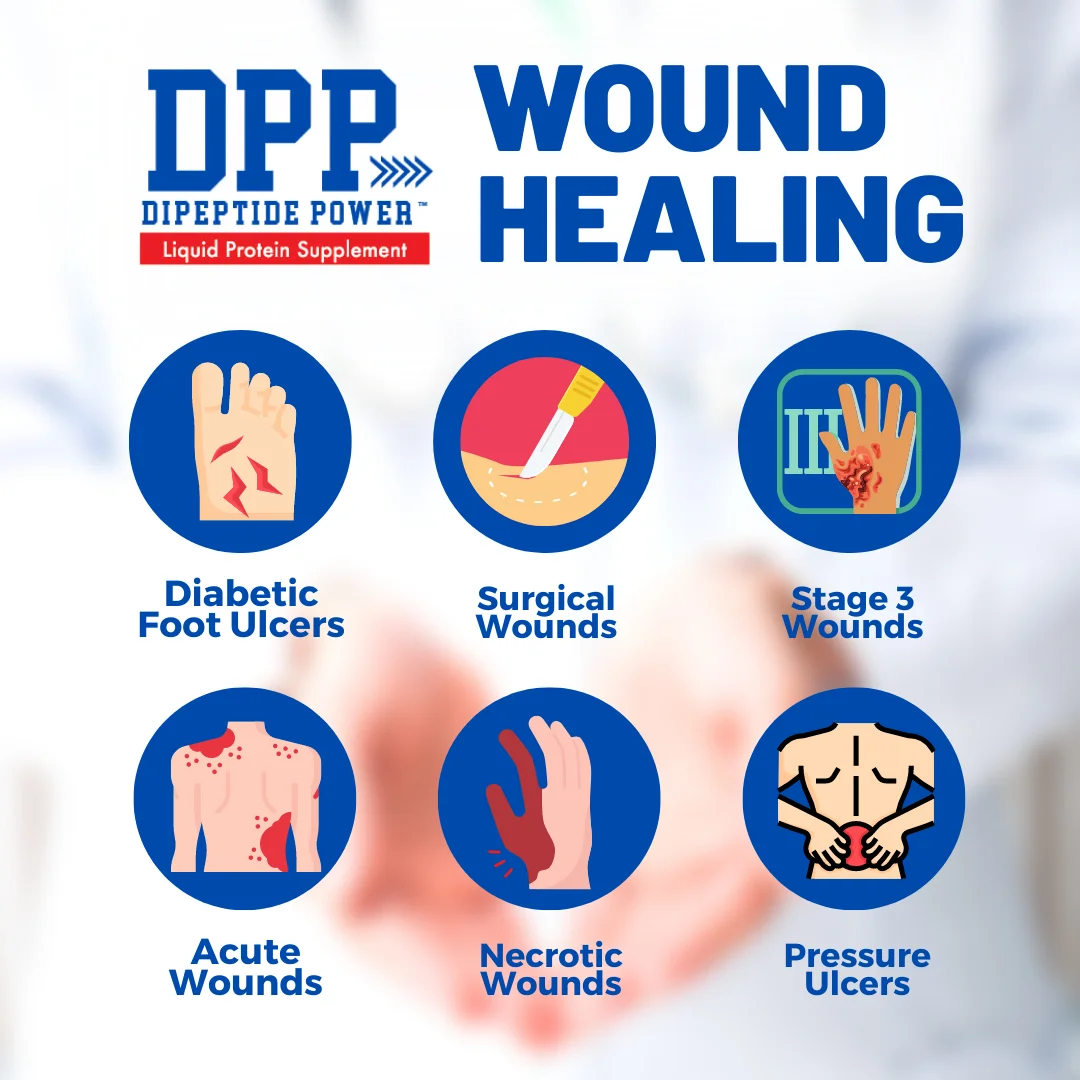 Dipeptide Power Liquid Collagen & Whey Protein Supplement by Nutritional Designs Cherry Flavor (32 Fluid oz)