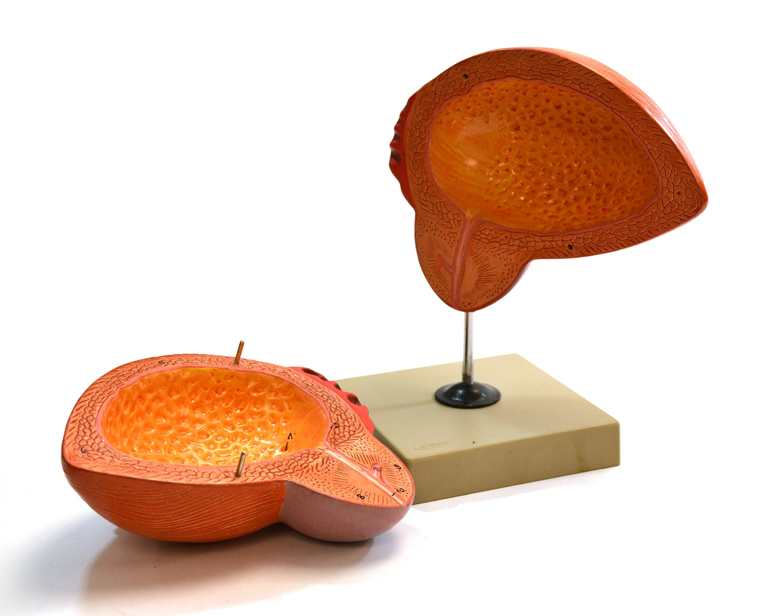 Eisco Labs Human Urinary Bladder with Prostate Anatomical Model, 2 Parts, 3 Times Life Size